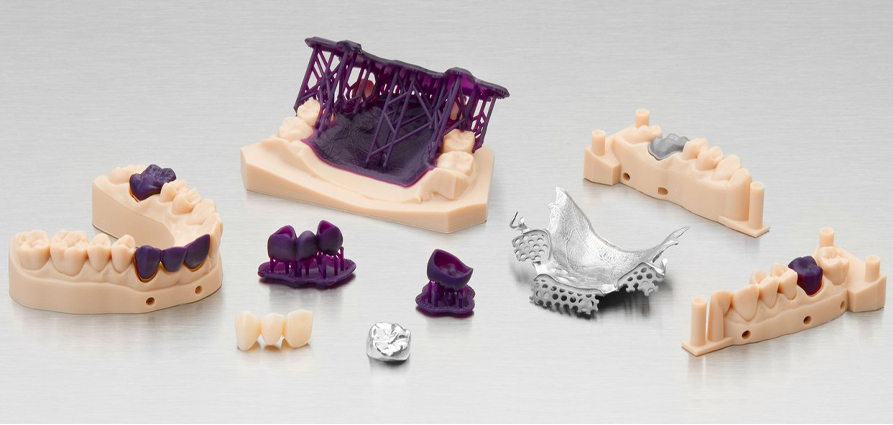 Impression 3D et le secteur dentaire