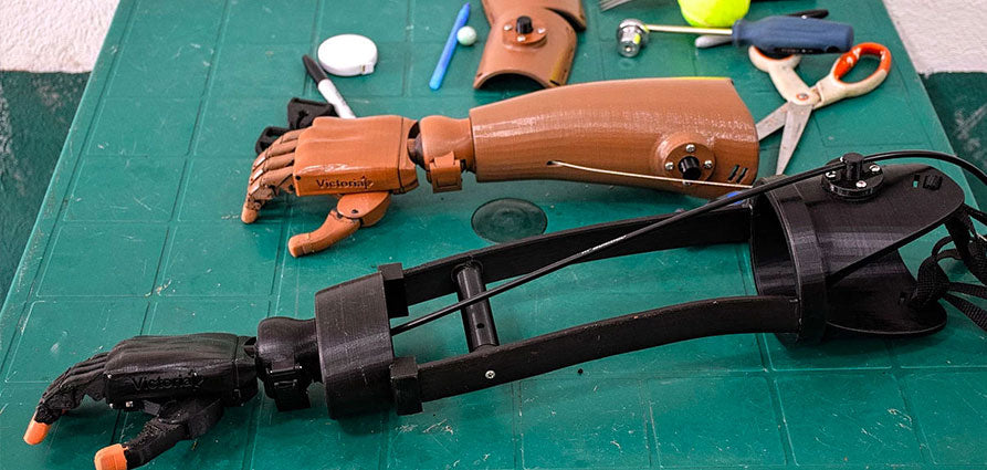 Intérêts des prothèses imprimées en 3D